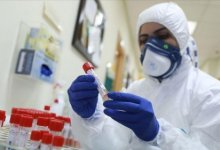 Photo of В Узбекистане коронавирус выявили у 141 гражданина