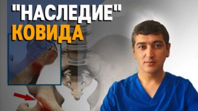 Photo of «Осложнение COVID-19 — резко выросла заболеваемость коксартрозом», — эксперт